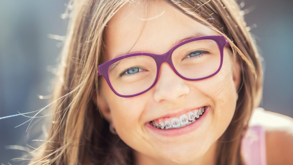 Quando Mettere l'Apparecchio ai Bambini: Segnali, Età Giusta e Ortodonzia Intercettiva 1 quando mettere l'apparecchio ai bambini